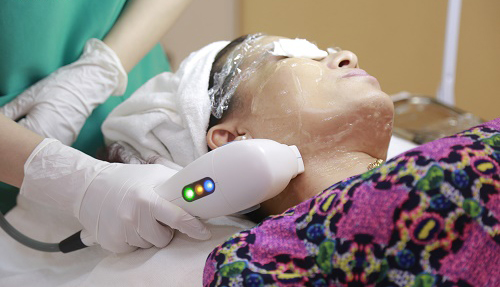 Trẻ hoá da bằng máy công nghệ hifu